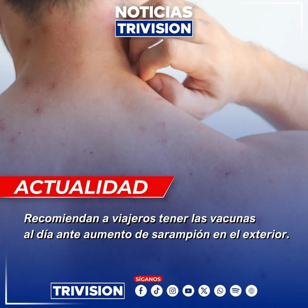 Aumento de casos de sarampión en las Américas: salud recomienda actualizar vacunas antes de viajar